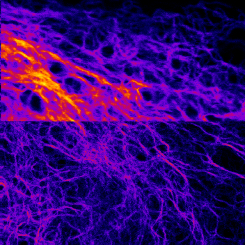 U2OS cells endogenously expressing vimentin rsEGFP2